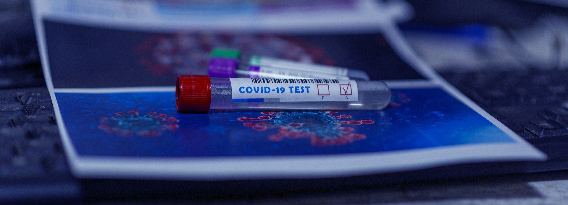 Dudas desde Tanzania sobre los Test de Coronavirus